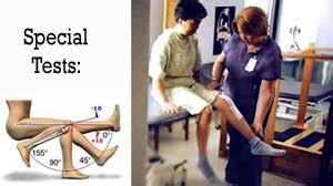 tibial torsion measurement special test|tibial torsion special test.